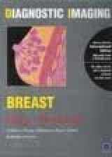 9780808923800-0808923803-Diagnostic Imaging Breast IE