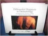 9781870905473-1870905474-Differential Diagnosis in Dermatology, Second Edition