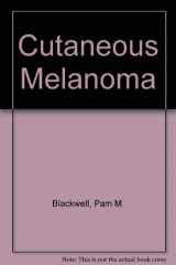 9781576261590-157626159X-Cutaneous Melanoma