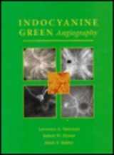 9780815197744-0815197748-Indocyanine Green Angiography