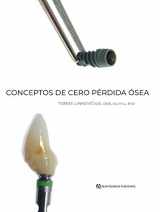 9788489873872-8489873879-Conceptos de Cero Pérdida Ósea (Spanish Edition)