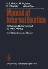 9783642965074-3642965075-Manual of Internal Fixation: Techniques Recommended by the AO Group