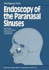 9783642684142-3642684149-Endoscopy of the Paranasal Sinuses: Technique · Typical Findings Therapeutic Possibilities