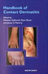 9781853178016-1853178012-Handbook of Contact Dermatitis