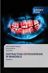 9786138947448-6138947444-DISTRACTION OSTEOGENESIS IN MANDIBLE: Dentistry