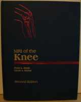 9780397516421-0397516428-Mri of the Knee