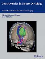 9781604067552-1604067551-Controversies in Neuro-Oncology: Best Evidence Medicine for Brain Tumor Surgery