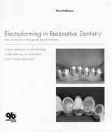 9780867153767-0867153768-Electroforming in Restorative Dentistry: New Dimensions in Biologically Based Prostheses