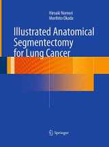 9784431561217-4431561218-Illustrated Anatomical Segmentectomy for Lung Cancer