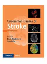 9781107147447-1107147441-Uncommon Causes of Stroke