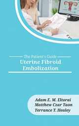 9781946665294-1946665290-Uterine Fibroid Embolization (The Patient's Guide)