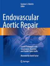 9783319792149-3319792148-Endovascular Aortic Repair: Current Techniques with Fenestrated, Branched and Parallel Stent-Grafts
