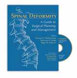 9781626236479-162623647X-Spinal Deformity: A Guide to Surgical Planning and Management