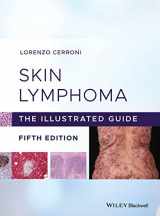 9781119485902-1119485908-Skin Lymphoma