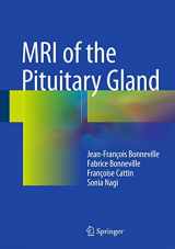 9783319290416-331929041X-MRI of the Pituitary Gland