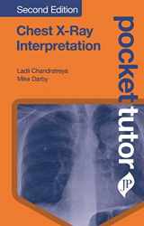 9781909836860-1909836869-Pocket Tutor Chest X-Ray Interpretation