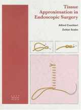 9781899066032-1899066039-Tissue Approximation in Endoscopic Surgery: Suturing & Knotting