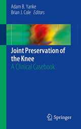 9783030014902-3030014908-Joint Preservation of the Knee: A Clinical Casebook