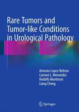 9783319102528-3319102524-Rare Tumors and Tumor-like Conditions in Urological Pathology