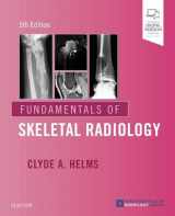 9780323611657-0323611656-Fundamentals of Skeletal Radiology