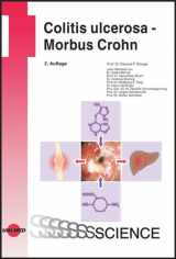 9783895998287-3895998281-Colitis ulcerosa - Morbus Crohn