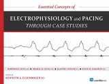 9781935395850-1935395858-Essential Concepts of Electrophysiology and Pacing through Case Studies