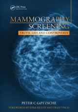 9781846195853-1846195853-Mammography Screening: Truth, Lies and Controversy