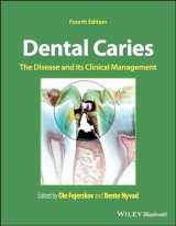 9781119679370-1119679370-Dental Caries: The Disease and its Clinical Management