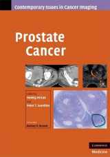 9780521887045-0521887046-Prostate Cancer (Contemporary Issues in Cancer Imaging)