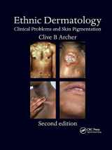 9780367386634-0367386631-Ethnic Dermatology: Clinical Problems and Skin Pigmentation