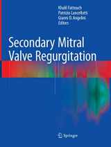 9781447170785-1447170784-Secondary Mitral Valve Regurgitation