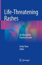 9783319756226-3319756222-Life-Threatening Rashes: An Illustrated, Practical Guide