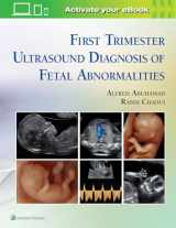 9781451193725-1451193726-First Trimester Ultrasound Diagnosis of Fetal Abnormalities