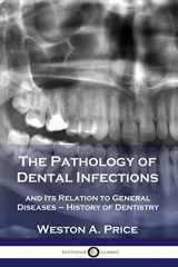 9781789872279-1789872278-The Pathology of Dental Infections: and Its Relation to General Diseases - History of Dentistry