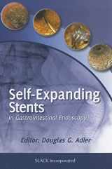 9781617110283-1617110280-Self-Expanding Stents in Gastrointestinal Endoscopy