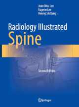 9789819966110-9819966116-Radiology Illustrated: Spine