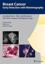 9783131485311-3131485310-Breast Cancer: Early Detection with Mammography: Crushed Stone-like Calcifications: The Most Frequent Malignant Type (Tabar Mammo)