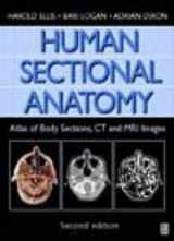 9780750633673-0750633670-Human Sectional Anatomy: Atlas Of Body Sections, CT and MRI Images