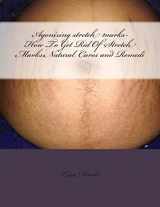9781497589070-149758907X-Agonizing stretch marks-How To Get Rid Of Stretch Marks:Natural Cures and Remedi