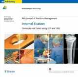 9789380378879-9380378874-AO Manual of Fracture Management Internal Fixators