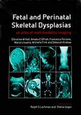 9781846194887-1846194881-Fetal and Perinatal Skeletal Dysplasias: an Atlas of Multimodality Imaging