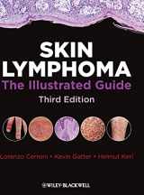 9781405185547-1405185546-Skin Lymphoma: The Illustrated Guide