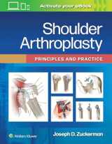 9781975157661-1975157664-Shoulder Arthroplasty: Principles and Practice