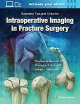 9781496328960-1496328965-Illustrated Tips and Tricks for Intraoperative Imaging in Fracture Surgery