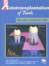 9780867153958-0867153954-Autotransplantation of Teeth