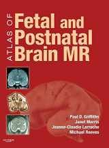 9780323052962-0323052967-Atlas of Fetal and Postnatal Brain MR