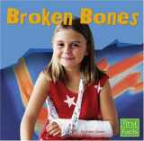 9780736863308-0736863303-Broken Bones (First Facts)