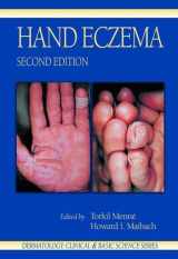 9780849373626-084937362X-Hand Eczema (Dermatology: Clinical & Basic Science)