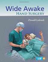 9781498714792-149871479X-Wide Awake Hand Surgery