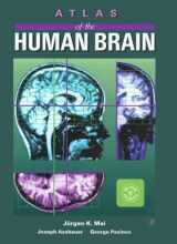 9780124653627-0124653626-Atlas of the Human Brain (Deluxe Edition)